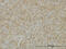 TNF Superfamily Member 14 antibody, LS-C133566, Lifespan Biosciences, Immunohistochemistry frozen image 