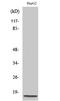 NDUFA4 Mitochondrial Complex Associated antibody, A09276-1, Boster Biological Technology, Western Blot image 