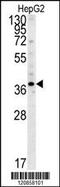 Proteasome 26S Subunit, Non-ATPase 7 antibody, MBS9205605, MyBioSource, Western Blot image 