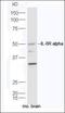 Interleukin 6 Receptor antibody, GTX37399, GeneTex, Western Blot image 