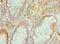 Transforming Growth Factor Beta Induced antibody, LS-C377451, Lifespan Biosciences, Immunohistochemistry paraffin image 