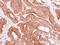 Eukaryotic Translation Initiation Factor 4A1 antibody, NBP2-16302, Novus Biologicals, Immunohistochemistry paraffin image 