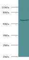 UGP1 antibody, LS-C317860, Lifespan Biosciences, Western Blot image 