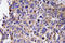 Matrix Metallopeptidase 12 antibody, LS-C292239, Lifespan Biosciences, Immunohistochemistry frozen image 