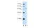 Potassium voltage-gated channel subfamily C member 1 antibody, 30-206, ProSci, Enzyme Linked Immunosorbent Assay image 