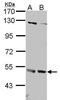Interferon Alpha And Beta Receptor Subunit 2 antibody, GTX105770, GeneTex, Western Blot image 