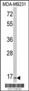 Thyroid Stimulating Hormone Subunit Beta antibody, MBS9210326, MyBioSource, Western Blot image 