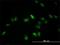 Transcription Factor EB antibody, H00007942-M01, Novus Biologicals, Immunofluorescence image 