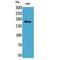 Laminin Subunit Gamma 2 antibody, LS-C387135, Lifespan Biosciences, Western Blot image 