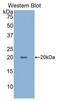 HIF1-alpha antibody, MBS2001771, MyBioSource, Western Blot image 