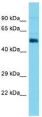 Aldehyde Dehydrogenase 1 Family Member A2 antibody, TA342735, Origene, Western Blot image 