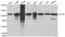 Actinin Alpha 1 antibody, A1160, ABclonal Technology, Western Blot image 