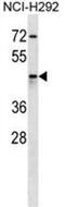 Aldo-Keto Reductase Family 1 Member C4 antibody, AP50134PU-N, Origene, Western Blot image 
