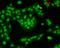 Calcium/Calmodulin Dependent Protein Kinase II Alpha antibody, M03241-1, Boster Biological Technology, Immunofluorescence image 