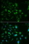 Toll Like Receptor 8 antibody, STJ25872, St John