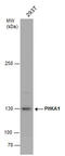 Phosphorylase Kinase Regulatory Subunit Alpha 1 antibody, GTX110318, GeneTex, Western Blot image 