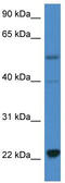 Interleukin 18 antibody, TA343041, Origene, Western Blot image 