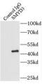 SET And MYND Domain Containing 3 antibody, FNab08049, FineTest, Immunoprecipitation image 