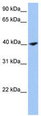 Calponin 2 antibody, TA340048, Origene, Western Blot image 
