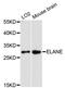 Elastase, Neutrophil Expressed antibody, A13015, ABclonal Technology, Western Blot image 