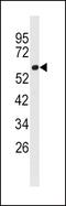 Acyl-CoA Synthetase Long Chain Family Member 3 antibody, PA5-12222, Invitrogen Antibodies, Western Blot image 