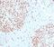 DNA Topoisomerase II Alpha antibody, 34-064, ProSci, Western Blot image 