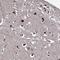 Anoctamin 10 antibody, NBP2-14297, Novus Biologicals, Immunohistochemistry frozen image 