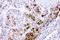 Cystathionine-Beta-Synthase antibody, LS-C357451, Lifespan Biosciences, Immunohistochemistry paraffin image 