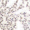 ETS Transcription Factor ELK1 antibody, abx000394, Abbexa, Immunohistochemistry frozen image 