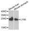 Lymphocyte Antigen 86 antibody, STJ27946, St John