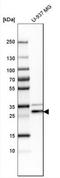 Canopy FGF Signaling Regulator 3 antibody, NBP2-23847, Novus Biologicals, Immunohistochemistry paraffin image 