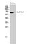 Cleavage Stimulation Factor Subunit 2 Tau Variant antibody, STJ92511, St John