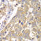 Phosphofructokinase, Muscle antibody, LS-C334085, Lifespan Biosciences, Immunohistochemistry paraffin image 