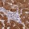 Glutathione S-Transferase Alpha 1 antibody, NBP2-46763, Novus Biologicals, Immunohistochemistry paraffin image 