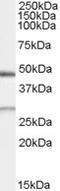 BCL2 Interacting Protein 1 antibody, STJ71277, St John