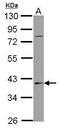 Serpin Family B Member 7 antibody, GTX122018, GeneTex, Western Blot image 