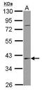 SERPINB7 antibody, GTX122018, GeneTex, Western Blot image 