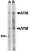 ATM Serine/Threonine Kinase antibody, LS-B1329, Lifespan Biosciences, Western Blot image 