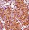 Iroquois Homeobox 3 antibody, LS-C165297, Lifespan Biosciences, Immunohistochemistry frozen image 
