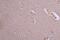 Neurotrophic Receptor Tyrosine Kinase 1 antibody, CSB-PA016133LA01HU, Cusabio, Immunohistochemistry frozen image 