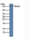 Receptor Like Tyrosine Kinase antibody, LS-C705562, Lifespan Biosciences, Western Blot image 