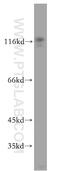 CD49D antibody, 19676-1-AP, Proteintech Group, Western Blot image 