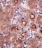 OTU Deubiquitinase 5 antibody, A09744, Boster Biological Technology, Immunohistochemistry paraffin image 