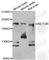 RPTOR Independent Companion Of MTOR Complex 2 antibody, A6131, ABclonal Technology, Western Blot image 