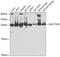 Hydroxysteroid 17-Beta Dehydrogenase 10 antibody, GTX33249, GeneTex, Western Blot image 