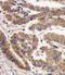 Protein Kinase C Zeta antibody, abx033125, Abbexa, Immunohistochemistry paraffin image 