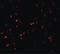 Myocardial Zonula Adherens Protein antibody, LS-B7042, Lifespan Biosciences, Immunofluorescence image 