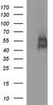 Interleukin 1 Receptor Type 2 antibody, TA506802BM, Origene, Western Blot image 