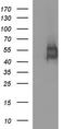 Interleukin 1 Receptor Type 2 antibody, TA506802BM, Origene, Western Blot image 