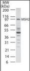 MutS Homolog 2 antibody, orb87825, Biorbyt, Western Blot image 